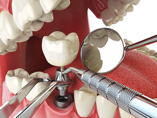 Best Weekend Emergency Dentist in Prudenville, MI