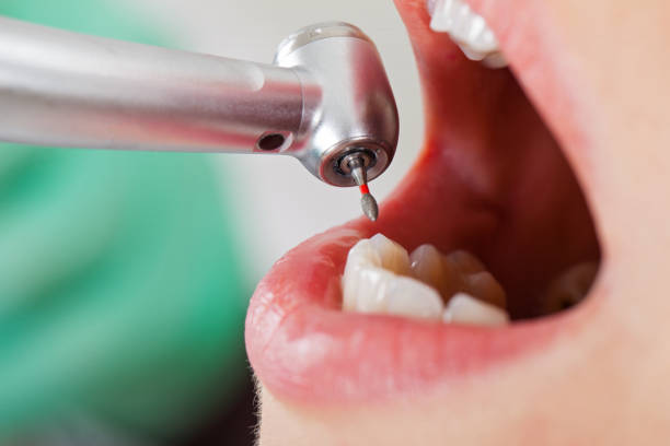 Best Same-Day Emergency Dental Services in Prudenville, MI